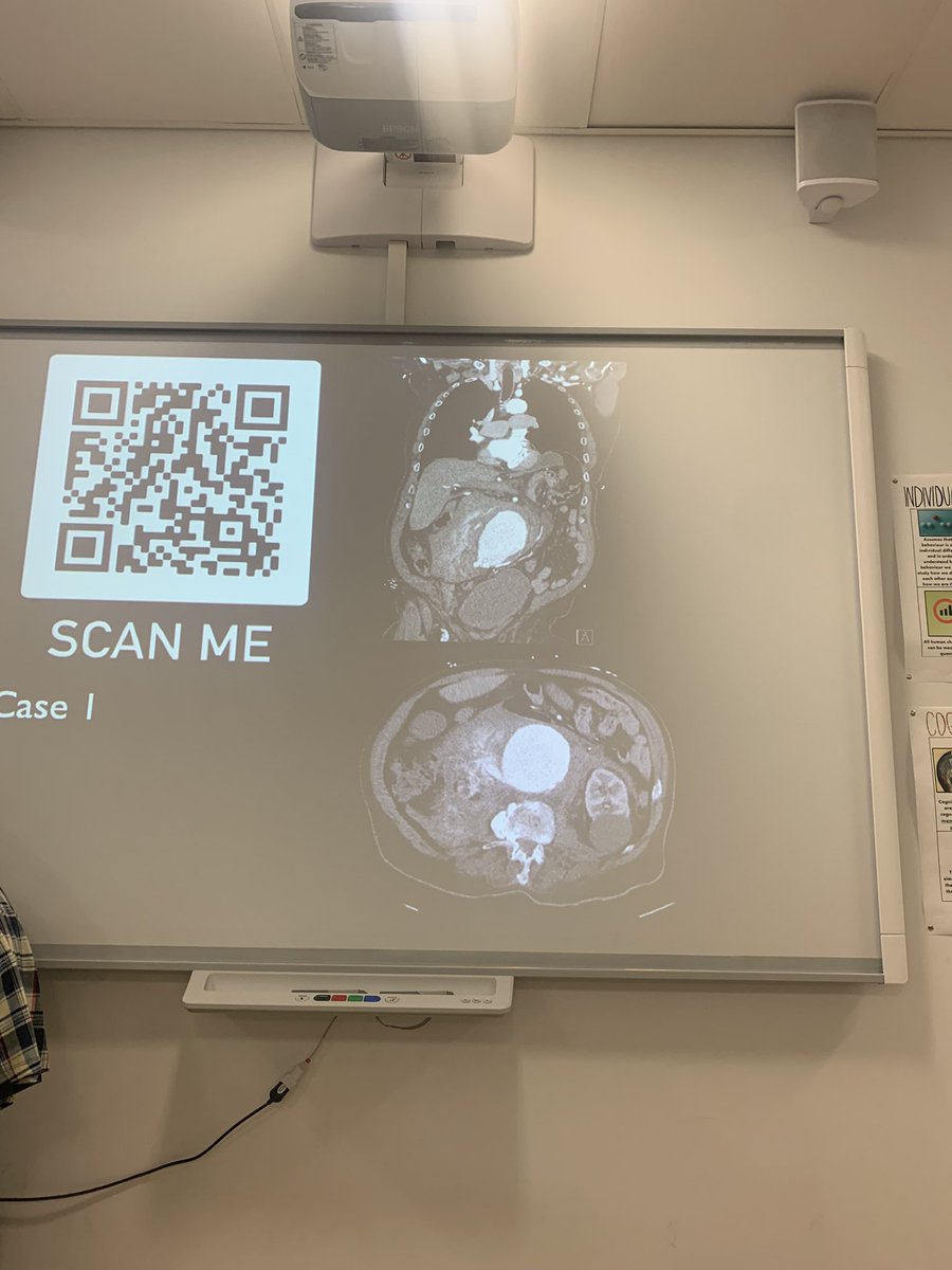 Tag team effort last week @commonweal6 taking about a career in medicine,surgery and radiology.An absolutely great group of engaged sixth formers.Great Q&amp;A. Good luck to all of you with your mock interviews and in the future! #greatwesternhospital #breastcareers