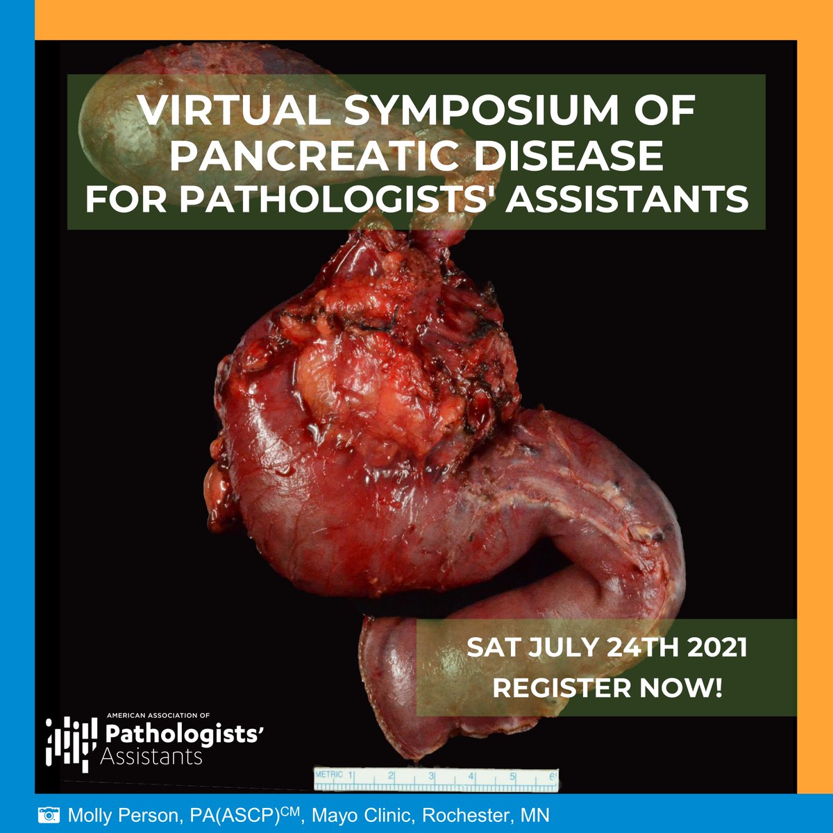 PathAssist's tweet image. Grossing a pancreas doesn’t have to be a pain! Join us for the Virtual Symposium of Pancreatic Disease for Pathologists' Assistants & expand your knowledge of pancreas pathology, grossing, tumor staging, patient care, & more!
More details & register here: pathassist.org/event/2021_sum…