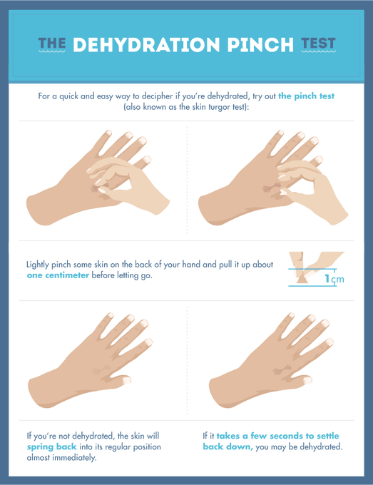 #Hydration is so important! Here is a test to see if you're #dehydrated! Try it out and let us know what you think!