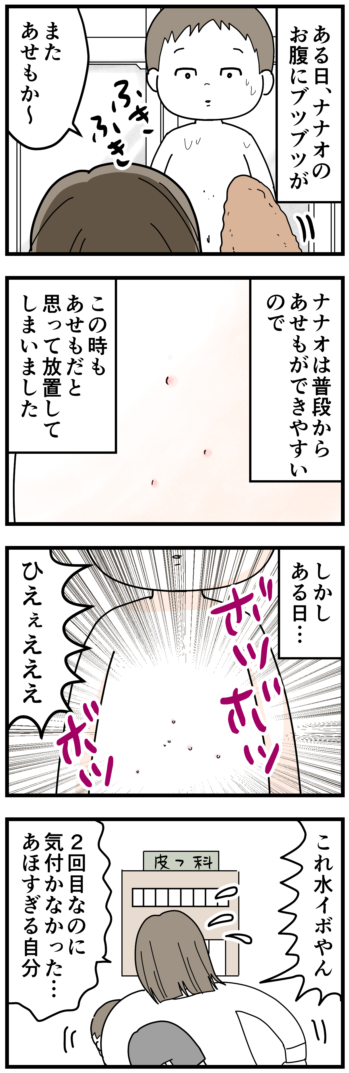 ちくまサラ 7y 3y ナナオの水イボ 詳しくはブログ記事にて T Co Qcb9tqkvzo 現在はお腹に次々にできたイボが赤くなってきてるので もうすぐ消えてくれる事を願ってます これに併用して ハトムギ茶 効果なし イボが集中してる場所に寝てる間