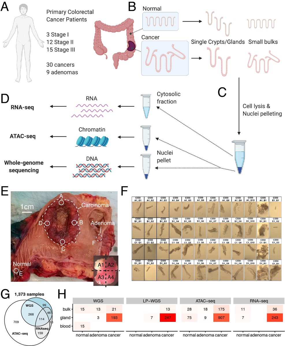 AndreaSottoriva's tweet photo. #EPICC (Evolutionary Predictions in Colorectal Cancer) project pre-print 1/3: concomitant multiomic spatial profiling of genome, chromatin and RNA on single glands. Non-genetic drivers and global #epigenetic rewiring. Tnx @wellcometrust @The_MRC @CR_UK https://t.co/KVNyZFW8Sl https://t.co/HeaE0vWgKl