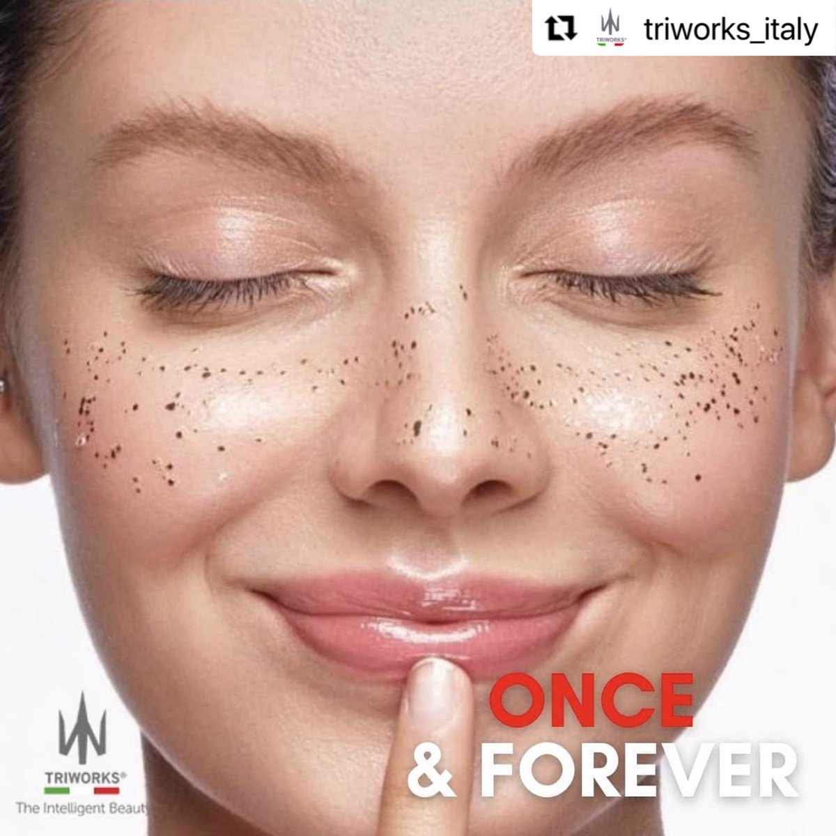 mariatradingco's tweet photo. #Repost @triworks_italy
ONCE &amp; FOREVER!

Can freckles be definitively eliminated? 
Yes, they can!

It is a SAFE, FAST AND EFFECTIVE treatment with our #PLASMA #AGEJET technology.
#MariaTrading
#aesthetic #medicaldevices #medical #skincare #healthcare #triworks #coldplasma https://t.co/PDqrqlRwoM
