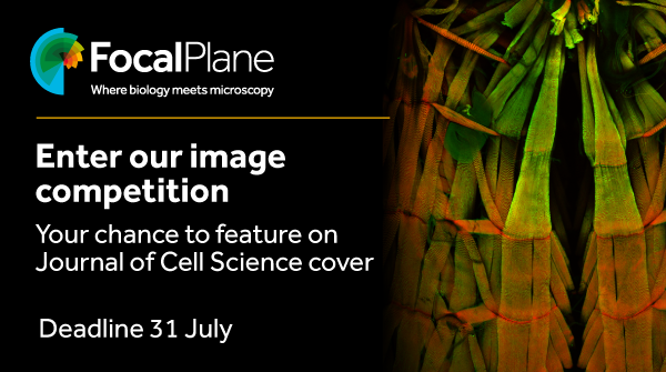 focalplane_jcs's tweet photo. Enter our image competition to have your image featured on the cover of Journal of Cell Science @J_Cell_Sci. 

Deadline to submit your image is 31 July
https://t.co/oV42vRp27W https://t.co/bHKxhnJ4Av