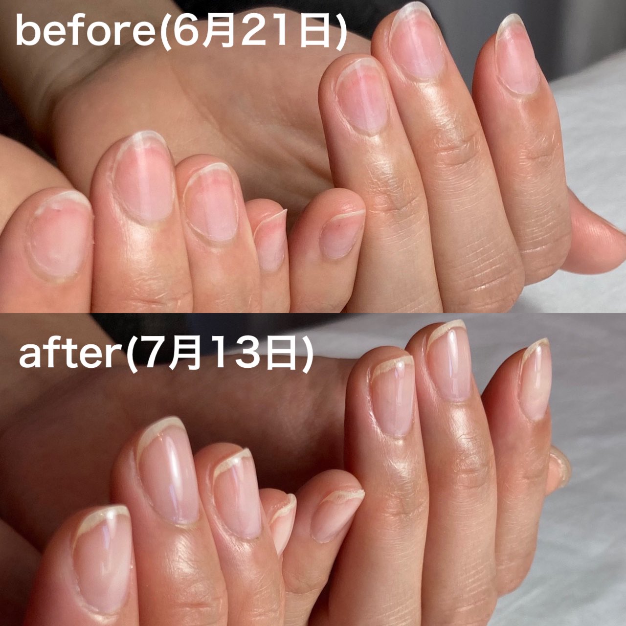 豊澤 瞳 とよさわ ひとみ みんな 爪 を育てるサロンに通ってから3週間で出た変化を見て ジェルし続けて薄くなって反っちゃってたのがふっくらして 爪の白いとこの始まり ストレスポイント が上がって のっぺりしてたのが引き締まって横幅が狭くなっ 豊澤 瞳 とよさわ ひとみ みんな 爪 を育てるサロンに通ってから3週間で出た変化を見て ジェルし続けて薄くなって反っちゃってたのがふっくらして 爪の白いとこの始まり ストレスポイント が上がって のっぺりしてたのが引き締まって横幅が狭くなっ