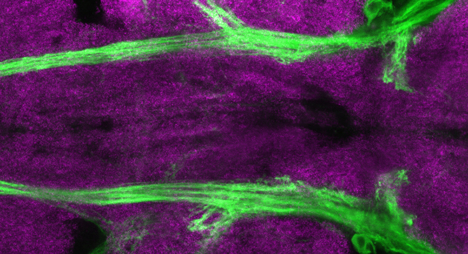 Neuroscientists in @TomchikLab have discovered how the mutated #NF1 gene can disrupt the metabolic rate of #neurons (green), pinpointing the roots of #neurofibromatosis type 1 and some types of #autism scripps.edu/news-and-event… <a href="/NatureComms/">Nature Communications</a> <a href="/vbotero15/">Valentina Botero</a>