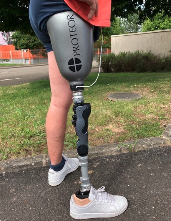 FreedomInnovate's tweet photo. How cool is this? This Plié® 3 microprocessor knee and Kinterra™ ankle paired with a custom PROTEOR branded socket looks AWESOME!
#Kinterra #Plie3 #WeAreProteor #Prosthetics https://t.co/4aACaJxwjA