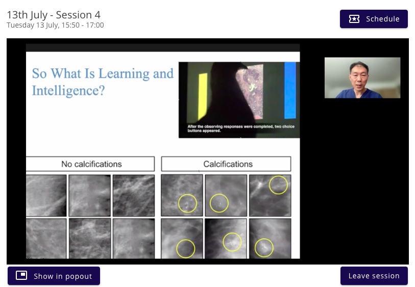 _the_SRT's tweet photo. For anyone wanting to learn more about the article referenced by RCR BSBR Travelling Professor Dr William Teh during his 'Breast Imaging' talk, please see https://t.co/p6s8nOPsk5 #SRT2021 #BSBR https://t.co/an51NjkzSp