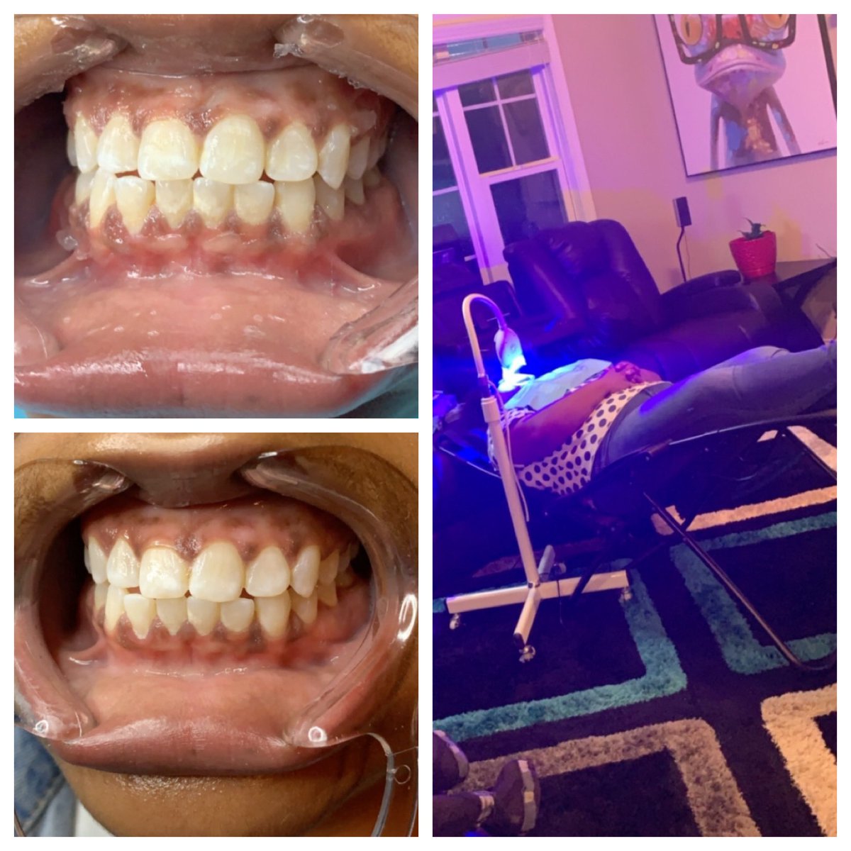 _v_c_r98's tweet photo. Schedule your appointment today for the mouth of august. The first 3 spots are taken so hurry!!! https://t.co/2Vmqr3nLqk