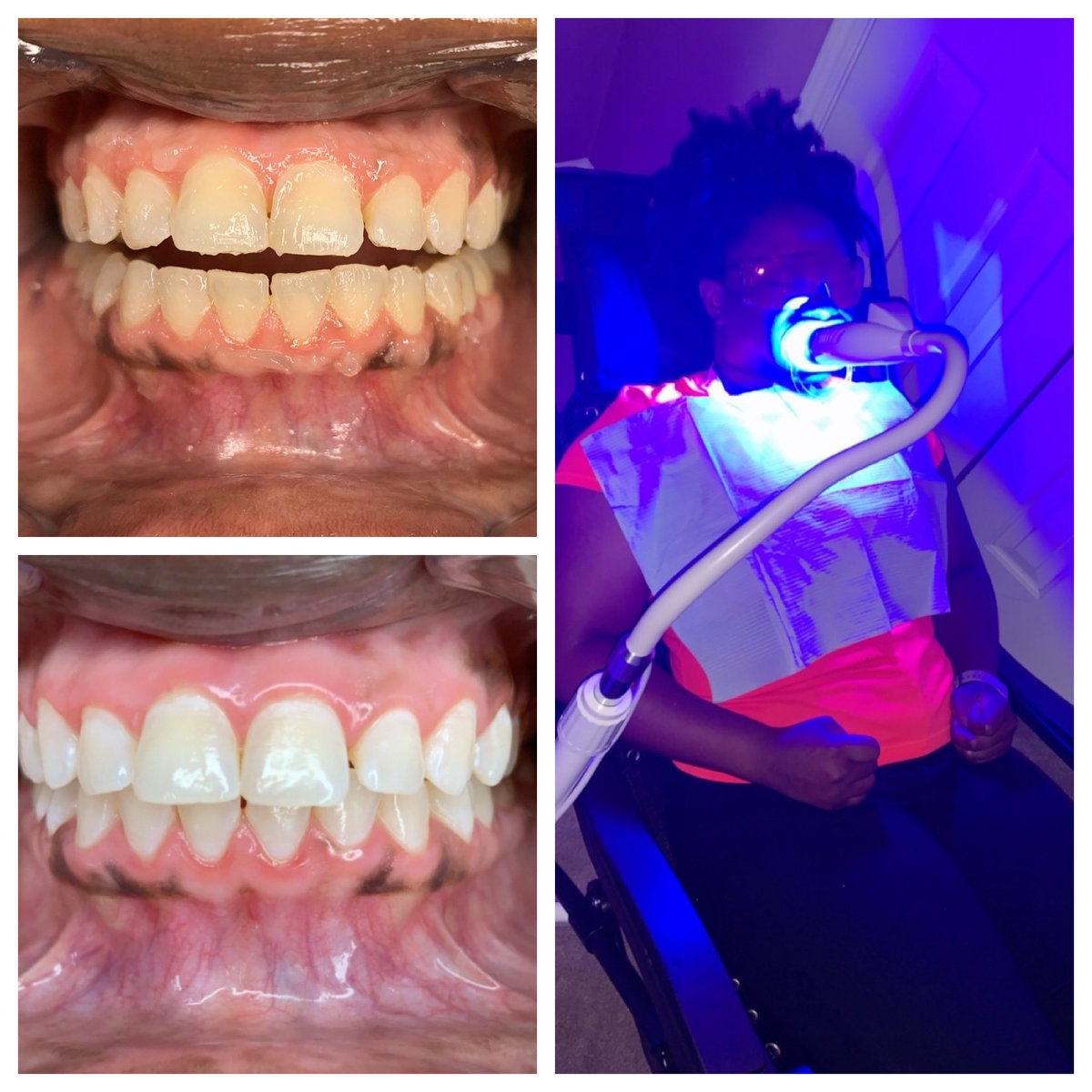 _v_c_r98's tweet photo. Schedule your appointment today for the mouth of august. The first 3 spots are taken so hurry!!! https://t.co/2Vmqr3nLqk