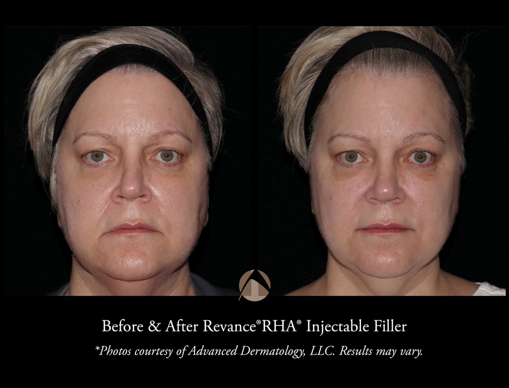 Advanced Dermatology on Twitter "Join Dr. Taub on Thursday at our