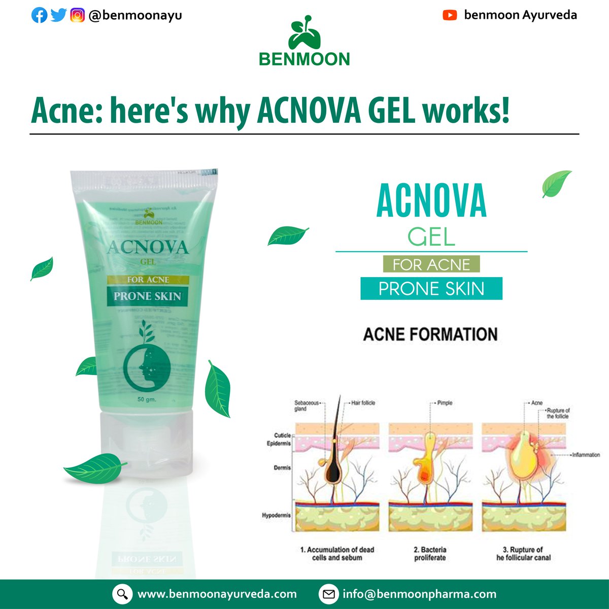 benmoonayu's tweet photo. MUST MUST TRY ACNOVAL GEL FOR ACNE PRONE SKIN
#acnova #acne #pimples #pimplesremover #acnecontrol #skinmarks #AcneMarks #pimplesolution #skincare #ayurvedaskincare #AyurvedicSkincare #beauty #benmoonproductchallenge https://t.co/LLmxowkvwE