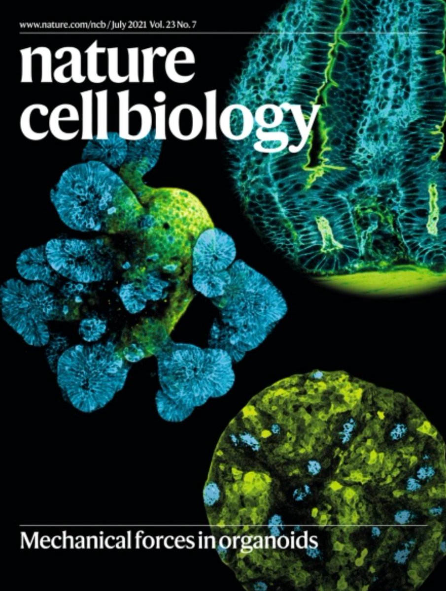 Xavier Trepat (@xaviertrepat) on Twitter photo Mechanical forces in organoids is the cover story of <a href="/NatureCellBio/">Nature Cell Biology</a>. Back to back papers by <a href="/priscaliberali/">Prisca Liberali</a> <a href="/EdouardHannezo/">Edouard Hannezo</a> and our lab! Cover image crafted by <a href="/gerardoceada/">Gerardo Ceada</a> <a href="/PerezGonzalezCa/">Carlos Pérez-González</a> and <a href="/QiutanYang/">Qiutan Yang</a> 😀🎈 <a href="/IBECBarcelona/">IBEC</a> <a href="/icreacommunity/">ICREA Community</a> Mechanical forces in organoids is the cover story of <a href="/NatureCellBio/">Nature Cell Biology</a>. Back to back papers by <a href="/priscaliberali/">Prisca Liberali</a> <a href="/EdouardHannezo/">Edouard Hannezo</a> and our lab! Cover image crafted by <a href="/gerardoceada/">Gerardo Ceada</a> <a href="/PerezGonzalezCa/">Carlos Pérez-González</a> and <a href="/QiutanYang/">Qiutan Yang</a> 😀🎈 <a href="/IBECBarcelona/">IBEC</a> <a href="/icreacommunity/">ICREA Community</a>