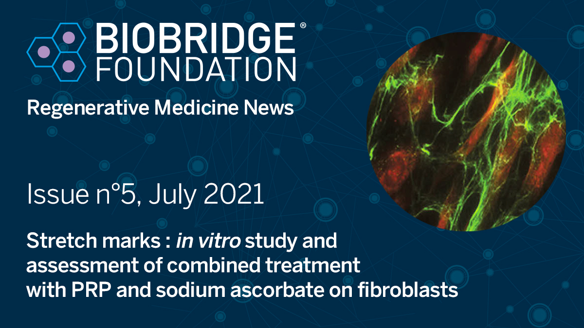 BioBridgeFDN's tweet image. Newsletter #5 is online! This month it focuses on an in-vitro study of combined treatment with PRP and sodium ascorbate on fibroblasts. Check out the online newsletter for more details at  bit.ly/3B0YR1L
#regenerativemedicine #plateletrichplasma #prptreatments