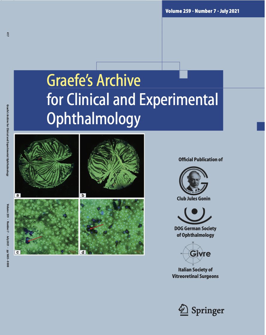 July cover rdcu.be/cnPix <a href="/DrHJLevis/">Hannah Levis</a> <a href="/DrVitoRomano/">Prof Vito Romano</a> <a href="/mohit_parekh21/">Mohit</a> <a href="/StPaulsNews/">St Paul’s News 💙</a> <a href="/LivuniILCaMS/">Institute of Life Course and Medical Sciences</a> artificial ant chamber optimizes #UT-DSAEK graft prep #ophthalmology <a href="/ClinMedJournals/">Springer Medicine</a> <a href="/Ophthalmologen/">DOG-Augenheilkunde</a> <a href="/meyer_professor/">Carsten H. Meyer</a> <a href="/oliverzeitz/">Oliver Zeitz</a> <a href="/AndrzejGrzybow/">Andrzej Grzybowski</a> <a href="/EdmundTsuiMD/">Edmund Tsui, MD</a> <a href="/SakamotoTaiji/">Taiji Sakamoto</a>