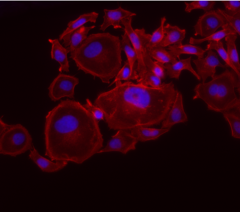 Sarcoma_UK's tweet image. Back to A Day in the Life of @MarkElms3:
10am: My first job @HuangLabICR is to fix a plate of #Sarcoma cells that have been growing for several weeks. Following this, the cells are stained with a dye that binds to DNA enabling us to visualise sarcoma cells under the microscope.