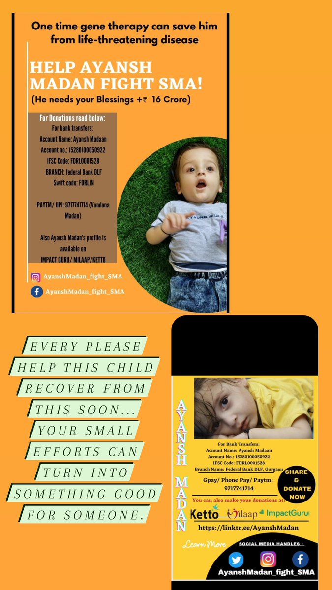 nisha2i's tweet photo. Plz help this child recover from this. Ur small efforts can bring smile in someone's life.
Plz take a small step as a goodwill nd blessing for him. 

@SonuSood
@akshaykumar 
@Ileana_Official 
@alluarjun @Asli_Jacqueline 
@diljitdosanjh @klrahul11 @AnushkaSharma @ishehnaaz_gill https://t.co/zaPehHgIHR