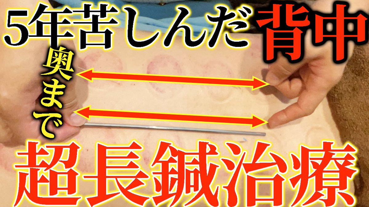 美容鍼キング 健康 美容のツボと鍼 上田 隆勇 Biyohari Twitter 美容鍼キング 健康 美容のツボと鍼 上田 隆勇 Biyohari Twitter