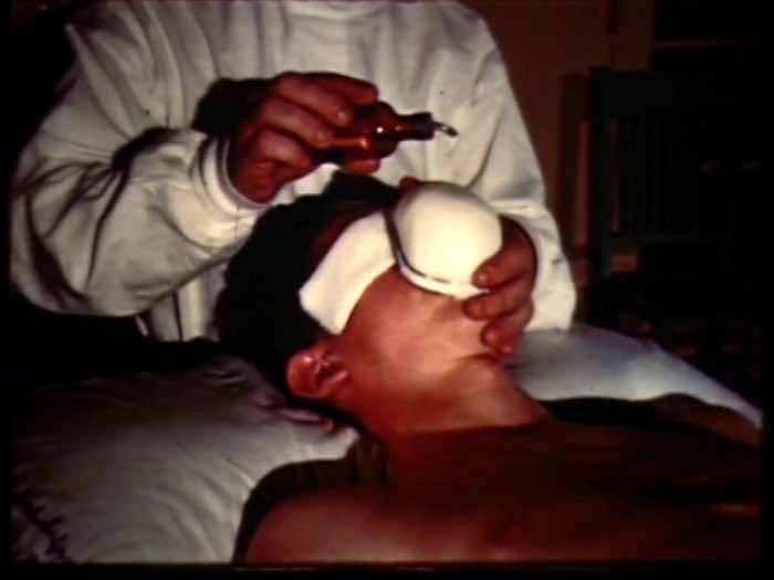 AnesPsmchs's tweet photo. 🔴 Open drop anesthesia: It is not used in modern anesthesia. 
A technique for producing inhalation anesthesia in which drops of a liquid anesthetic, such as ether, are placed on a gauze mask or cone applied over the mouth and nose. https://t.co/Hqvw7hALBy