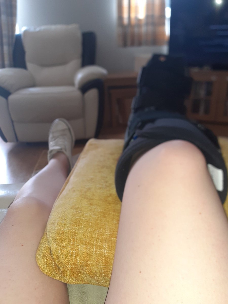 Just over four weeks before the wedding and this happens 🙈. Fingers crossed it is off before the hen at the weekend 😅. #wedding2021 #bridetobe