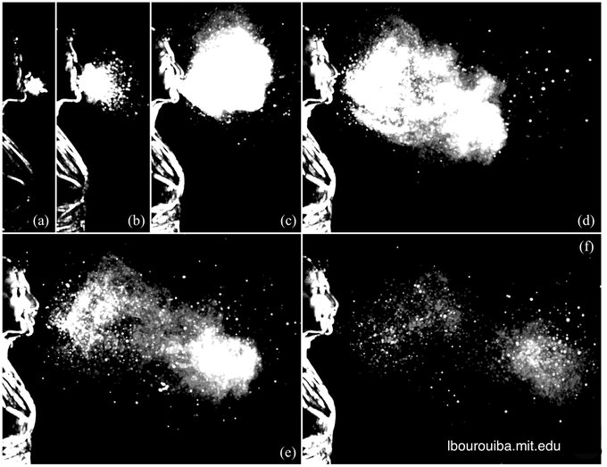 Stop motion images of person sneezing