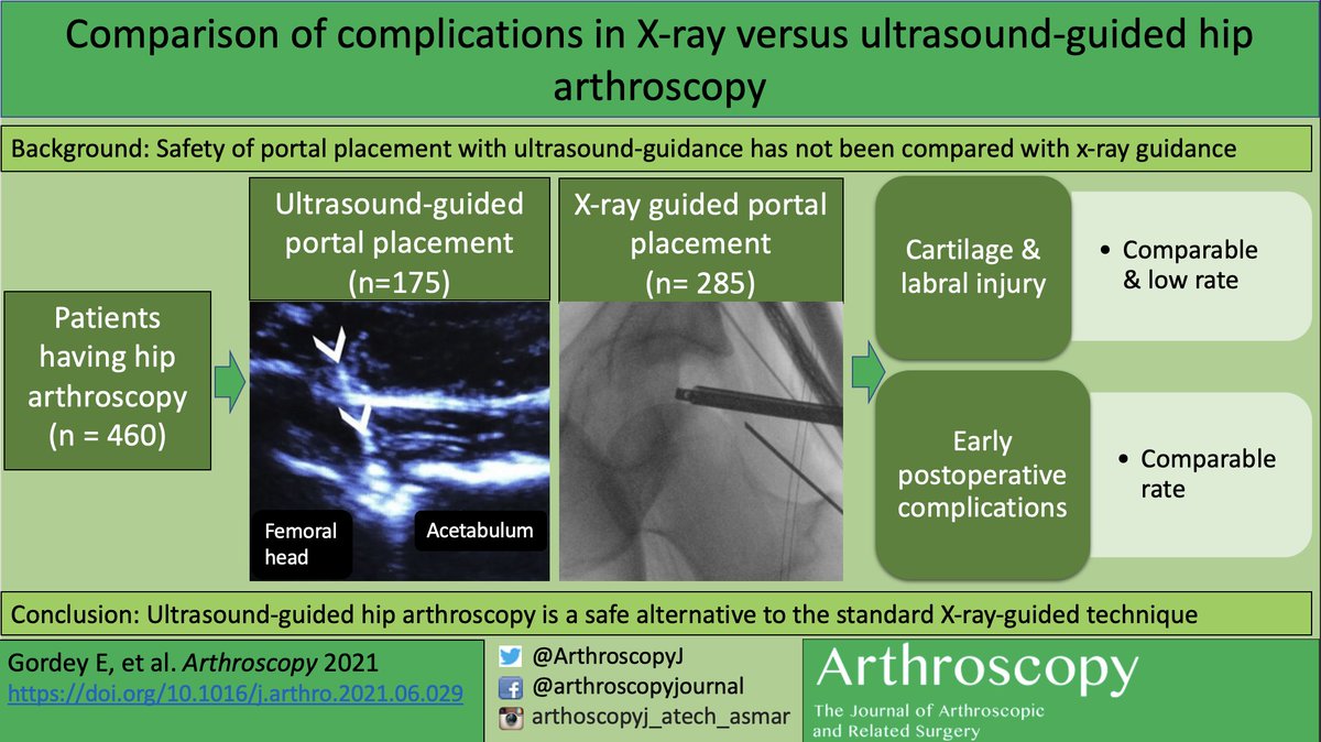 Comparison of complications in X-ray versus ultrasound-guided hip arthroscopy. <a href="/SportsMedMD/">Ivan Wong, MD</a> 
ow.ly/vNNA50FvWZa