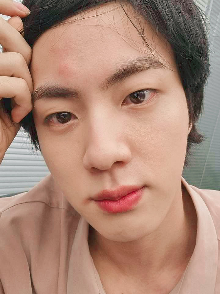 jinsprotect's tweet photo. a baby and its bruise 🙁 #JIN #진 https://t.co/VDnHfu9Vl7