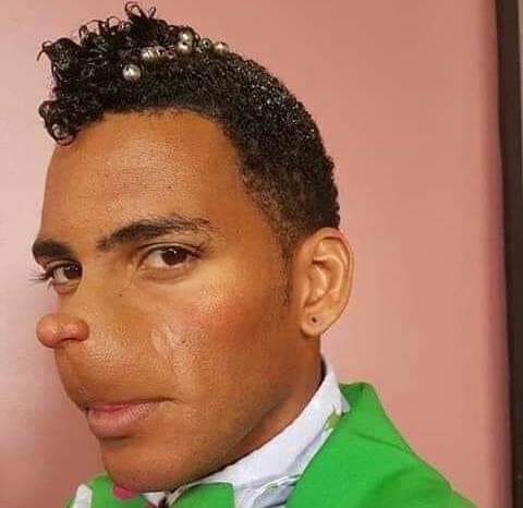 La morra que se hizo la rinoplastia por $2,500