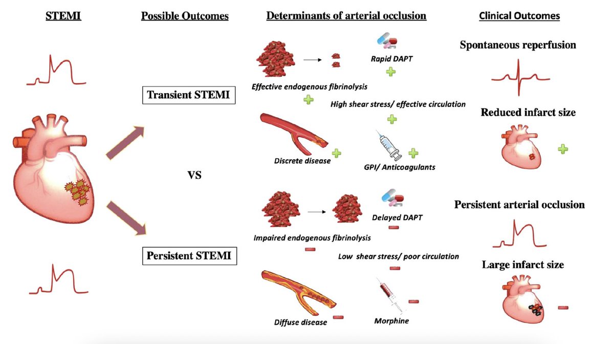 SUPRA ST TRANSITORIO: 
🫀Buena revisión 
🫀Trombos de menor tamaño y fragilidad
🫀Beneficio de terapia antitrombótica potente inicial
🫀Menos miocardio en riesgo
link.springer.com/article/10.100…