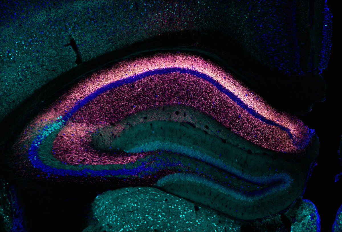 ACWhitebirch's tweet photo. Less than four weeks to my defense, so I figured it's time for another CA2 picture! This is from a mouse with Syn-mRuby (yellow) and mGFP (magenta) expressed in dorsal CA2 pyramidal neurons. In this section, the dorsal-originating axons form synapses throughout CA1, CA2, and CA3. https://t.co/vYBphy6wlN