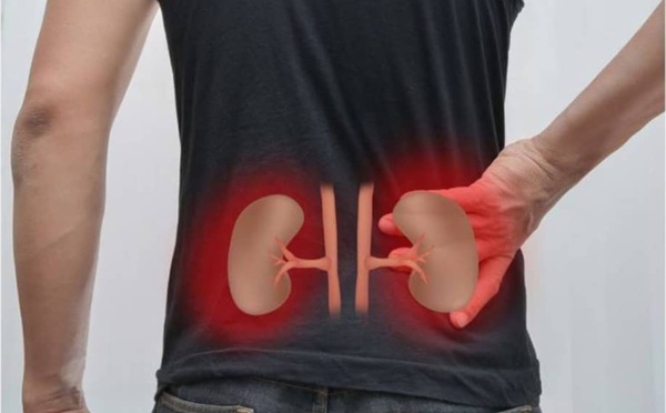 Le chocolat peut-il aider les patients atteints des maladies rénales ? La maladie artérielle périphérique (MAP) touche plus de 200 millions de personnes dans le monde. Il a été prouvé que les flavanols de cacao tels que... | #chocolat #chococlic chococlic.com/Le-chocolat-pe…