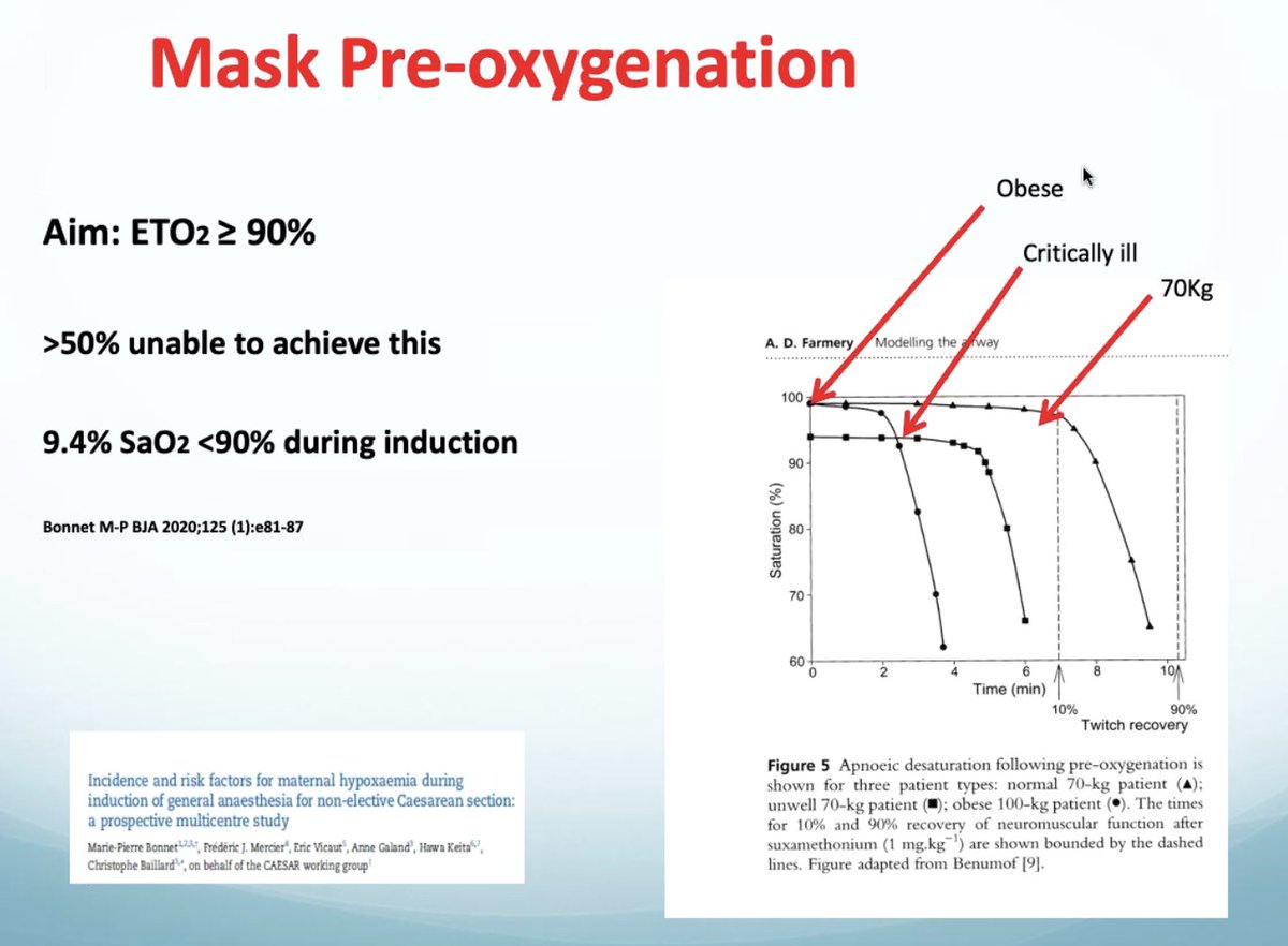 Excited to contribute <a href="/OAAinfo/">OAA</a> Obstetric Airway Webinar this morning moderated by @mikekinsella10 - starting of with the Obstetric RSI Checklist
✔️ postion
✔️ pre-oxygenation