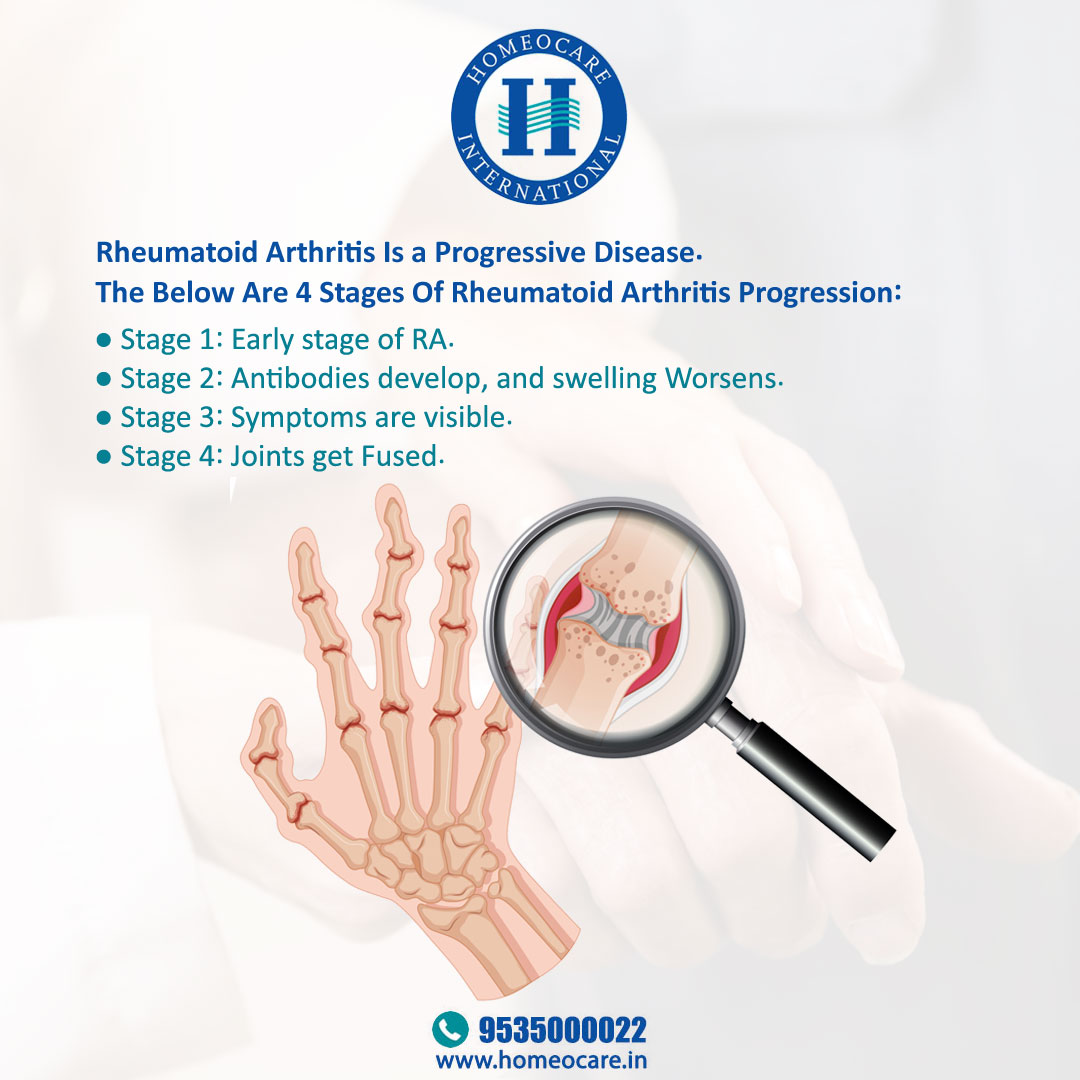 SafeHomeopathy's tweet photo. 4 Stages of Rheumatoid Arthritis Progression

#arthritis #arthritisrelief #septicarthritis #homeopathy #PositiveHomeopathy #homeocare #PositiveResults https://t.co/Gq5B1qOgk4