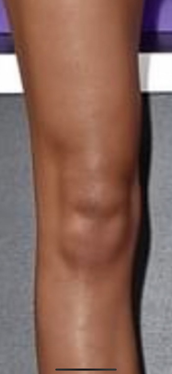 CarsonDrae's tweet photo. Someone please explain how @Zendaya’s knee looks eerily similar to @Lesdoggg?? 🤣 I love both of these ladies! #ItsAllJokes #Zendaya #LeslieJones #Knee #LookALike https://t.co/8nM6OykR8i