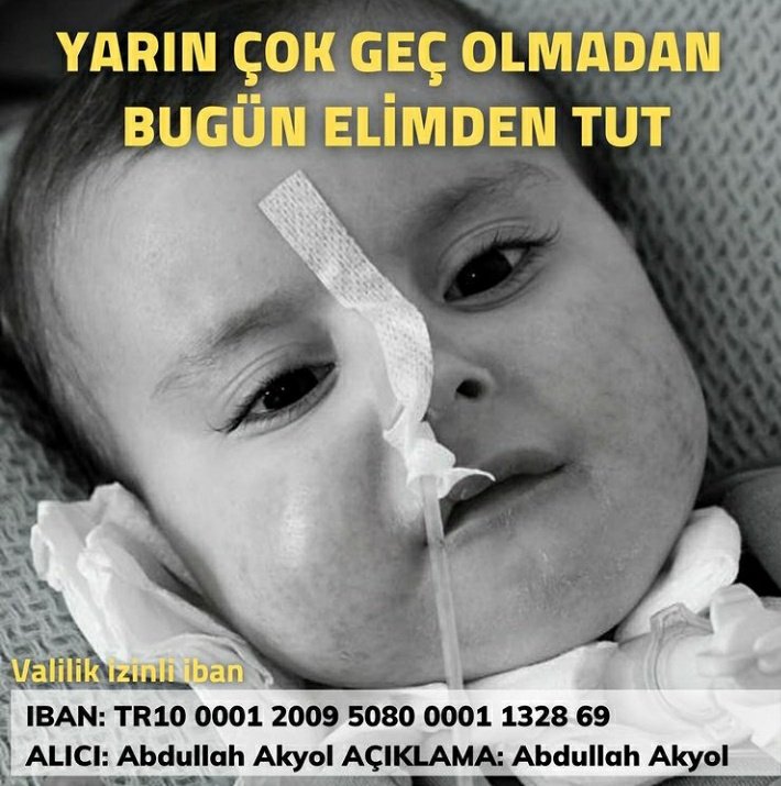 Burada gördükleriniz muhammed ali nin en iyi hali oğlum çok acı çekiyor en azından rt yaparak destek olun 

Melih Bulu #iyikigeldinbaba #15Temmuz Selman Öğüt Ahmet Nur Çebi Binali Yıldırım Fetö Metallica #BizimZaferimiz30Ağustos  #BoğazIçiDireniyor Gelen #Rize #BizHalaNöbetteyiz