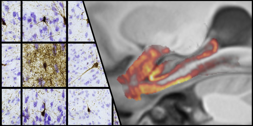 Yushkevich et al. use MRI and dense serial histology to construct the first three-dimensional maps of tau neurofibrillary tangle pathology at individual and group levels. bit.ly/3khw5Ek