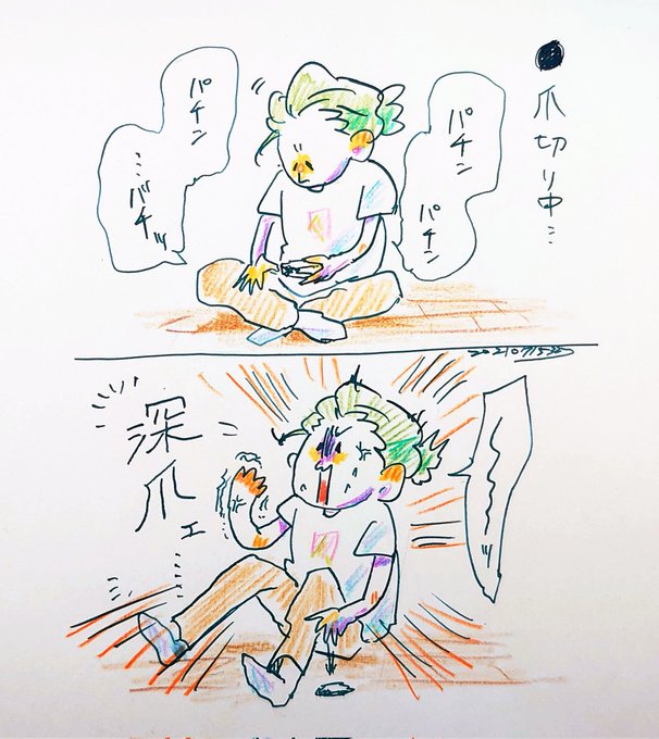 いつかの深爪騒動。実際どこの指を負傷したのでしょう。お大事に。 
