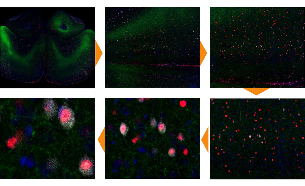 TissueGnostics's tweet photo. WHAT IS WHOLE SLIDE CONFOCAL IMAGING?
How Does Whole Slide Confocal Imaging Work?
Read the full article: https://t.co/ncBxLiq0Rz
https://t.co/gAMD6ECMfX
.
.
#tissuecytomerty #stratafaxsII #tissuegnostics #tissuefaxs #wholeslideimaging https://t.co/qT9Ph1qXX4