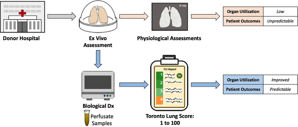 JHLT (@thejhlt) on Twitter photo A cytokine-based ex vivo perfusion lung score for surgical decision-making in lung transplantation #PrecisionMedicine <a href="/SKeshavjee/">Shaf Keshavjee</a> @uhnsurgery bit.ly/3hv2Cou A cytokine-based ex vivo perfusion lung score for surgical decision-making in lung transplantation #PrecisionMedicine <a href="/SKeshavjee/">Shaf Keshavjee</a> @uhnsurgery bit.ly/3hv2Cou