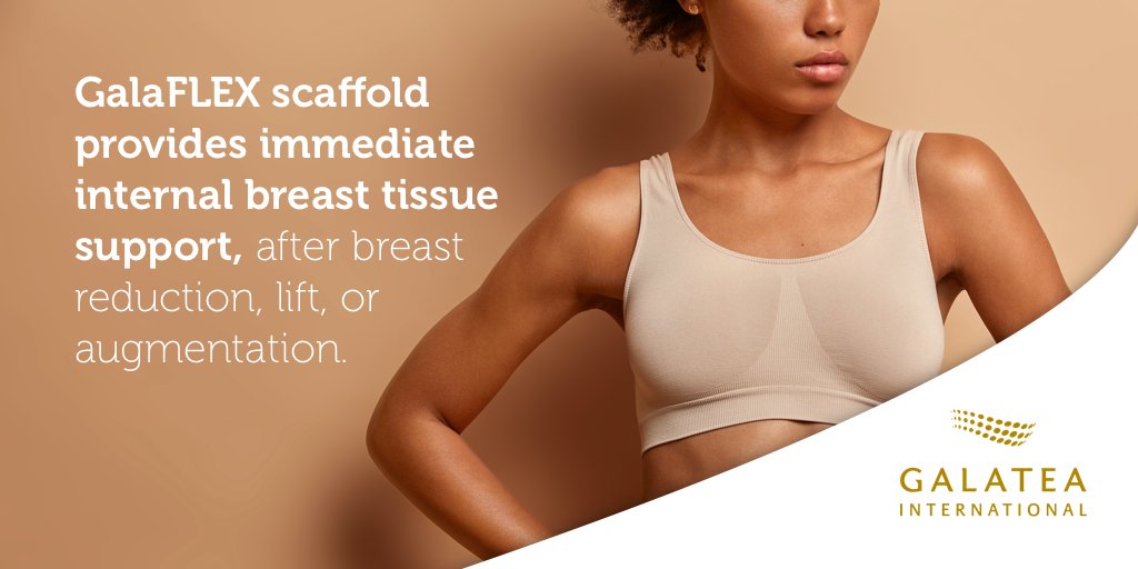 galatea_inter's tweet photo. GalaFLEX scaffold provides immediate internal soft tissue support, after breast reduction, lift, or augmentation. #GalaFlex #PlasticSurgery #InternalBra https://t.co/Lja6q9sAck