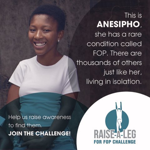 fop_tin's tweet photo. This is Anisepho, she has a rare condition called FOP. There are thousands of others just like her, living in isolation. Help us find them!
#fopchallenge #raisealegforfop #helpusfindthemissing #tinsoldiersfoppatientsearch #raredisease #CareAboutRARE https://t.co/pRdZ42slc0