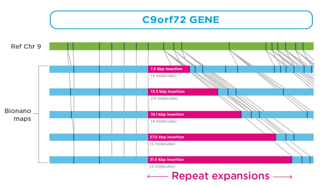 See how the #Bionano Saphyr® system detected a highly mosaic range of expansions in a single postmortem brain sample from an ALS patient. No other technology has been capable of spanning &amp; measuring these large repeat expansions. bit.ly/3hluWIE
#DNA #Genomics