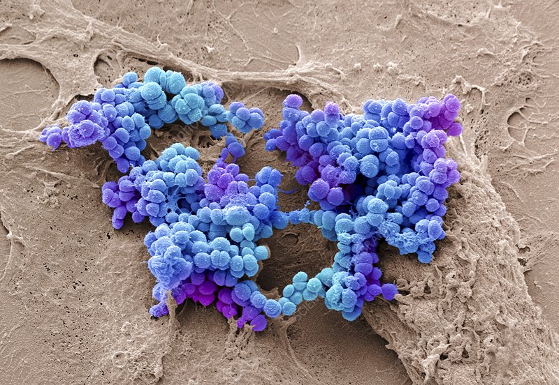 IBT_inc's tweet photo. Check this out! 

IBT-V02: A Multicomponent Toxoid Vaccine Protects Against Primary and Secondary Skin Infections Caused by Staphylococcus aureus

#researchanddevelopment #research #vaccinedevelopment #biotechnology #vaccine

https://t.co/8bmHqaS2Ae https://t.co/ivxYlF2kZx