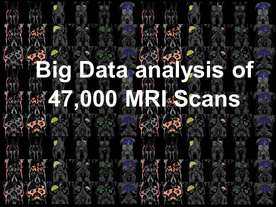 Metabolic Imaging (@imagingfat) on Twitter photo Huge thanks to <a href="/SSIBsociety/">SSIB</a> extremely honoured to be invited to present our research in their Big Data session today. Thoroughly enjoyed the fantastic presentations from <a href="/Bankslab/">Alex Banks</a> <a href="/cdiou/">Christos Diou</a> <a href="/Witte1Veronica/">Veronica Witte 🇺🇦</a> and subsequent discussion. Huge thanks to <a href="/SSIBsociety/">SSIB</a> extremely honoured to be invited to present our research in their Big Data session today. Thoroughly enjoyed the fantastic presentations from <a href="/Bankslab/">Alex Banks</a> <a href="/cdiou/">Christos Diou</a> <a href="/Witte1Veronica/">Veronica Witte 🇺🇦</a> and subsequent discussion.