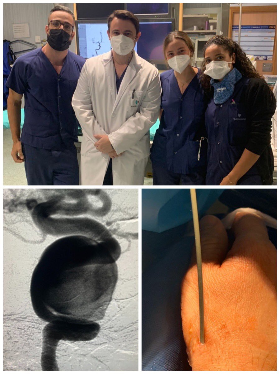 Ya hemos puesto en marcha la unidad de Neurointervencionismo en <a href="/Hospital_LaLuz/">Hospital La Luz</a> . Hemos puesto un especial interés en el acceso radial para el tratamiento de patología cerebrovascular compleja que permite una rápida recuperación de los pacientes. #seguimos #teamwork