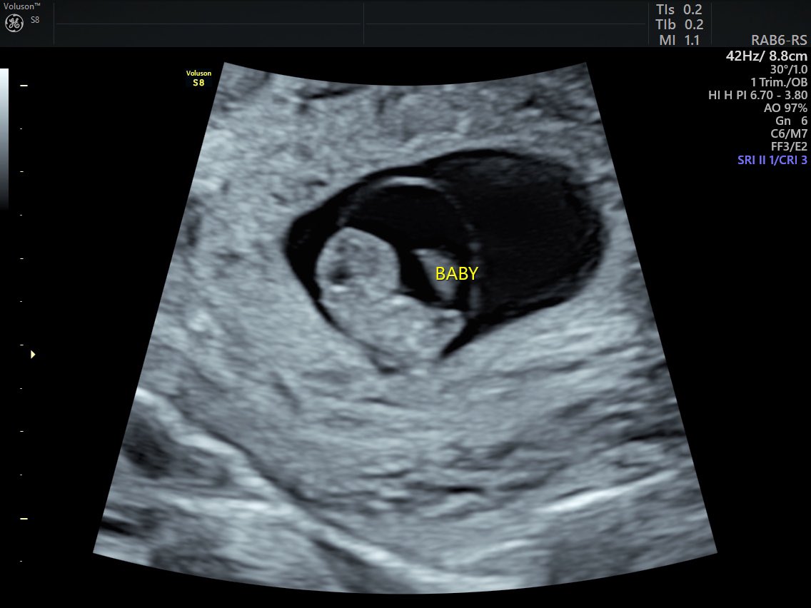 Jake Kemp tweet media