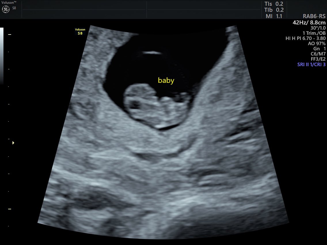 Jake Kemp tweet media