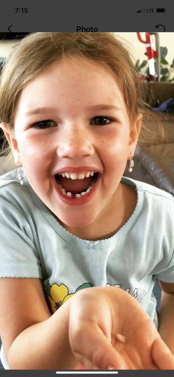 derek_ashcroft's tweet photo. Big day in the Ashcroft house ... Lennox lost her first tooth. #biggirl #slamthedoortoothpull https://t.co/X5gnVcQUCS