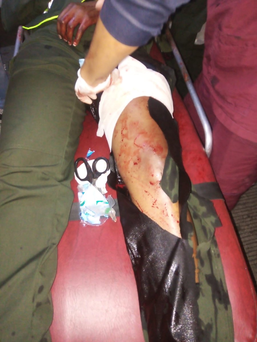 CWMasNoticias's tweet photo. Atención

Una mujer auxiliar de Policía, fue apuñalada cuando atendía un incidente de hurto en un bus del MIO

La auxiliar fue llevada a centro hospitalario. https://t.co/LNF254NWbS