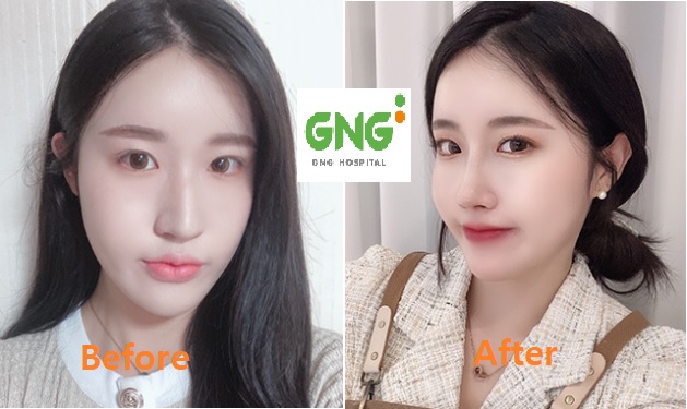 団子鼻 Twitter Search