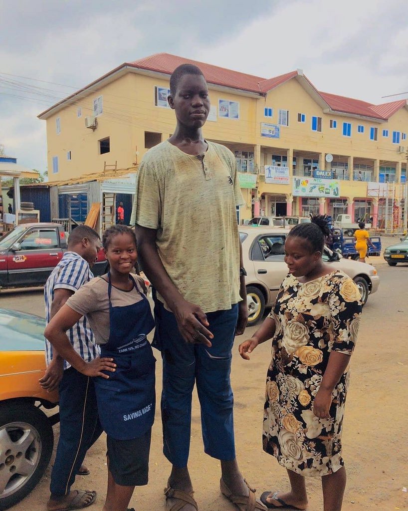 I task our local shoe production companies and fashion designers to take up this young man and brand him with customized shoes and clothes for him. 
Let’s put a smile on his face. 
His story saddens my heart 🙏😞